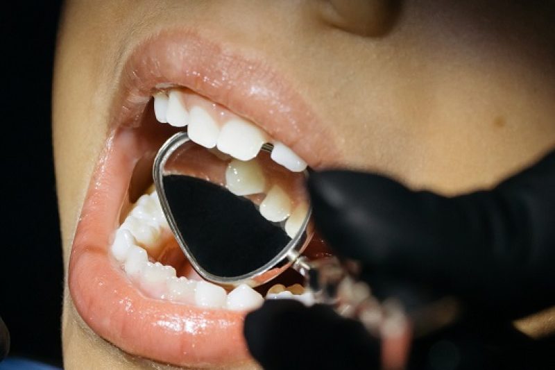 Should I Pull Out My Child's Loose Tooth?